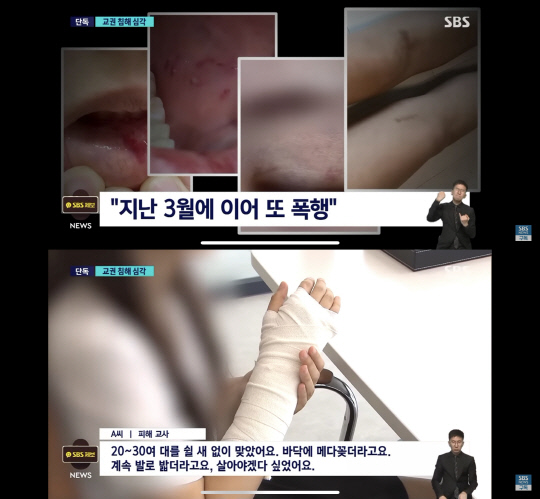 SBS 보도 화면 캡처